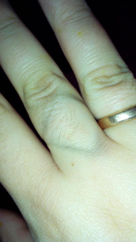 Золотое кольцо и чернота под ним.. что делать?