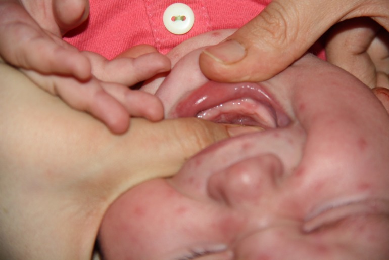 что с деснами??? Очень нужна ваша помощь!