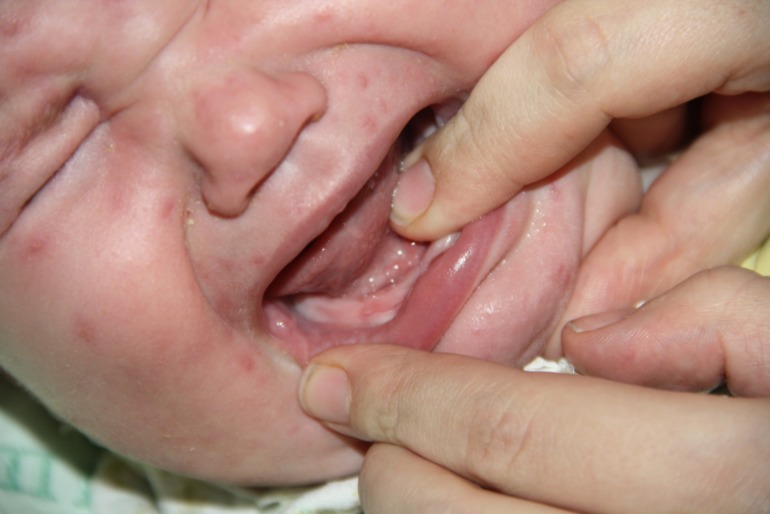 что с деснами??? Очень нужна ваша помощь!