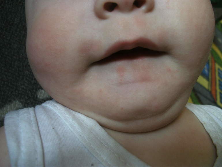 Может, я просто мнительная?((