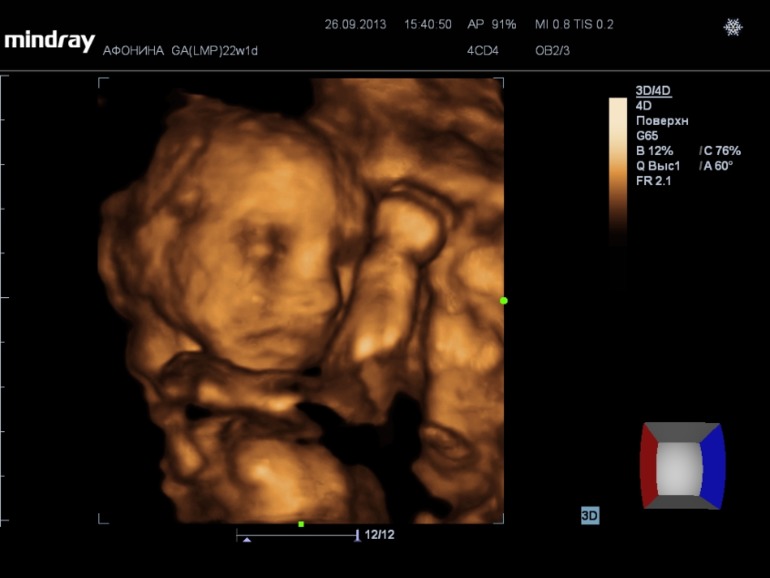 Наши супер-результаты узи)))