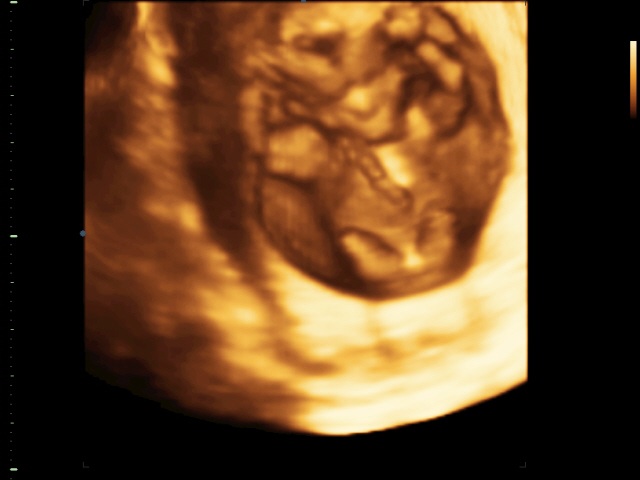 Тридэшечка