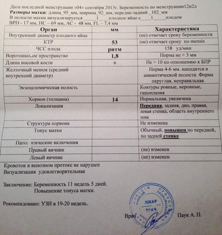 Наконец-то! Наше узи в 12 недель:)