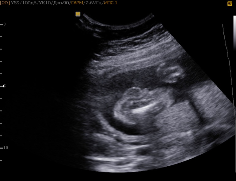 Подскажите кто в животике?!?!!