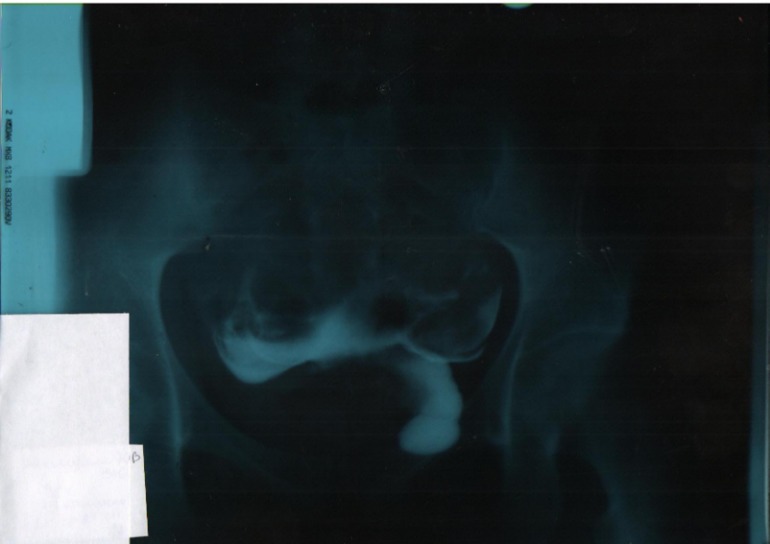 Результат ГСГ