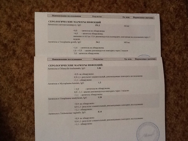 Помогите расшифровать?!!!это что?!!!!!!