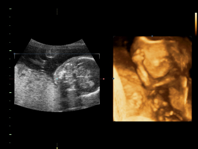 Сынуля был прав!!!! В пузике...