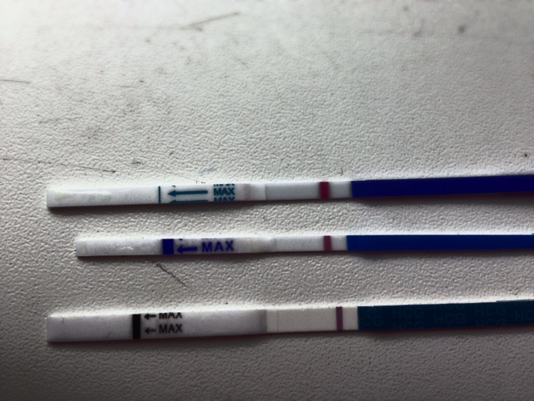 9 дпо или 7/8 дпо)