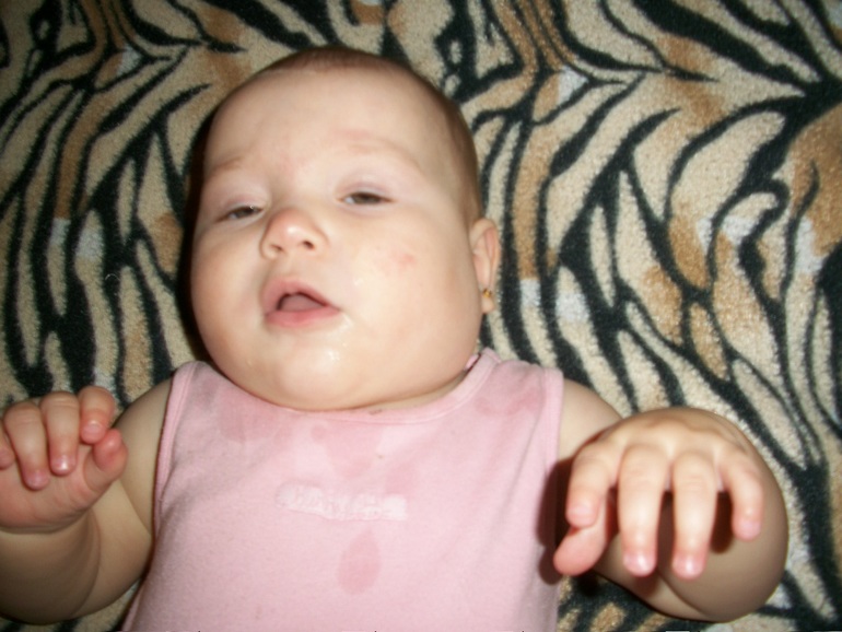 Я рыдаю!!! Неужели свинка в 10 мес??? Фото.