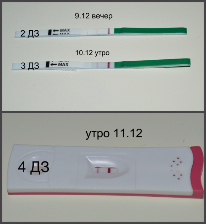 Тест на 1 месячные. Тесты на беременность до за. Тест на беременность до задержки. Тесты после задержки. Тесты после задержки месячных.