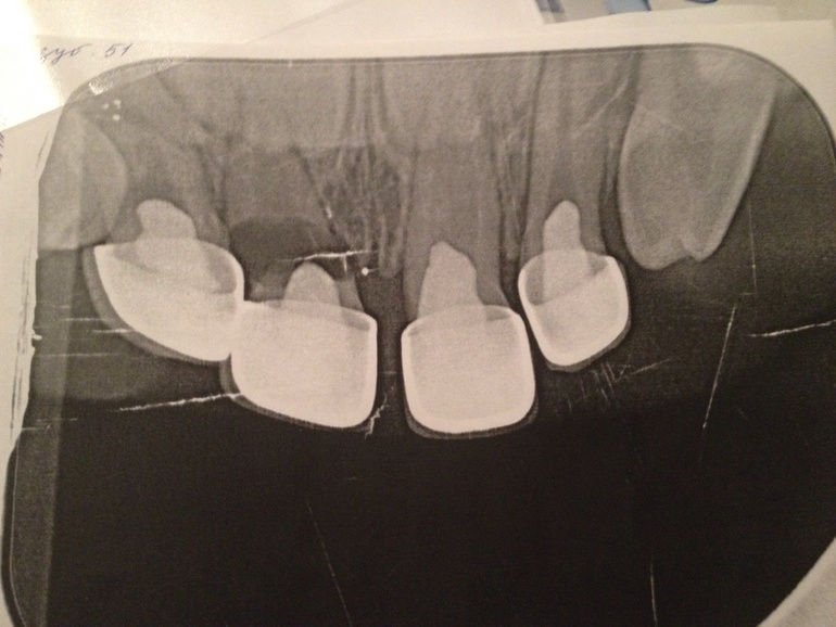 Что посоветуете?