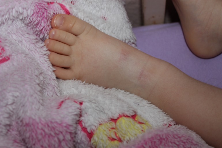 Шершавые пятна