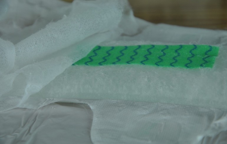 Анионовые прокладки