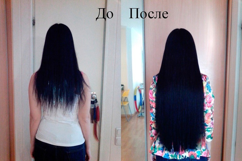 Кто делал? И что потом будет с волосами?