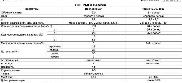 В шоке от спермограммы... Жду комментов!