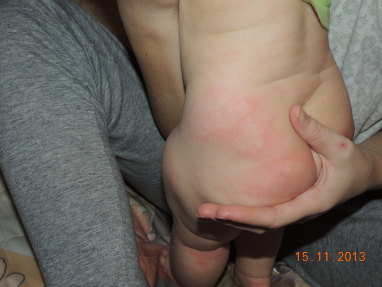 Что на нас опять напало?