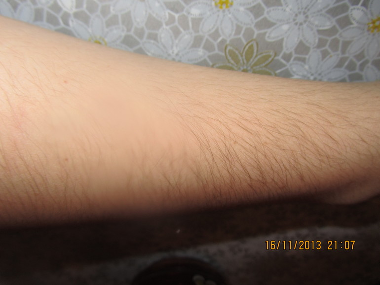 Удаляем над губой.....))))