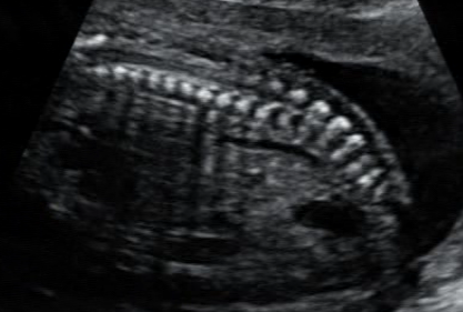 Стоп-кадры УЗИ (из видеоматериала)