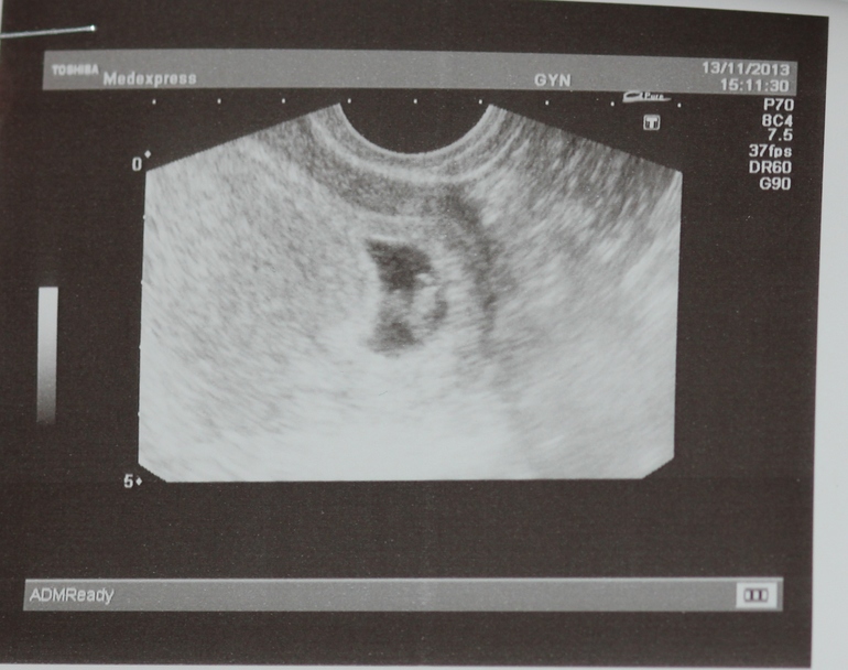 И я к вам присоединяюсь))))