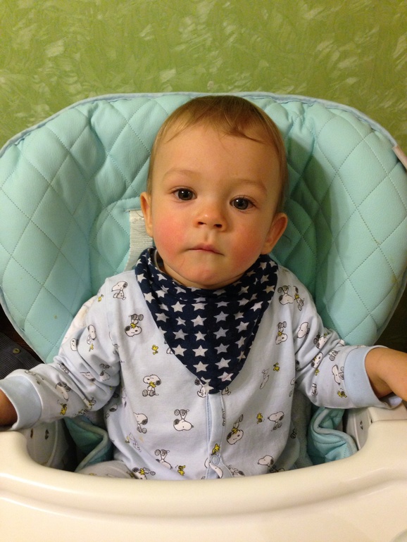 Бывает ли аллергическая реакция на Манту?