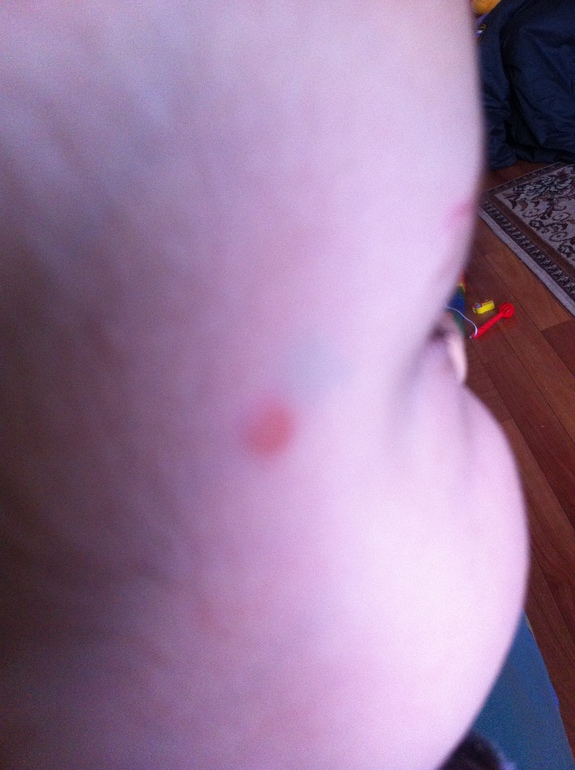 два пятнышка...что это???