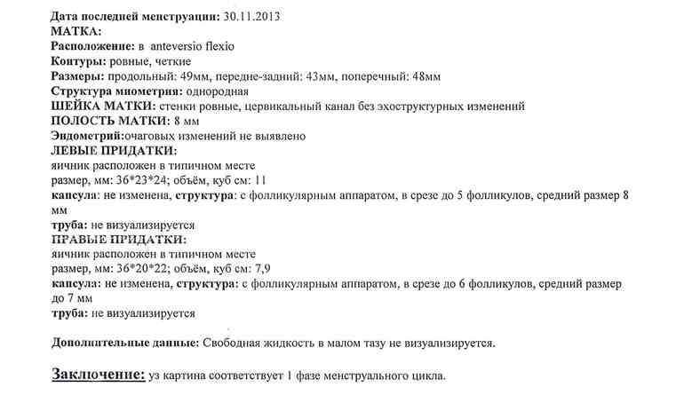 Динамика узи, как мой полет?