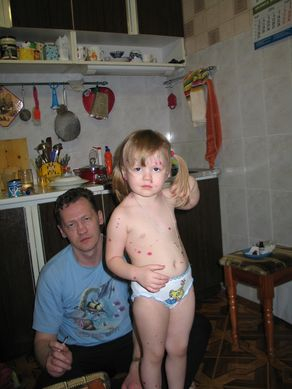 Пятнышко