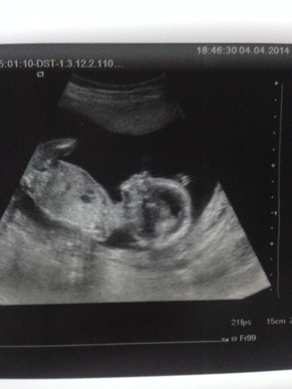 18 недель мальчик. Малыш на УЗИ В 18 недель мальчик. Снимок УЗИ мальчика на 18 недели.