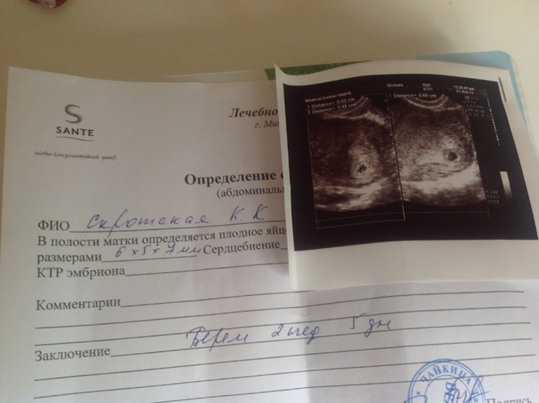 А вот и наша бусинка))