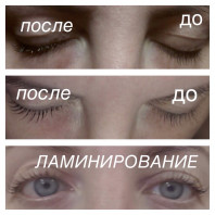 Ламинирование ресниц Мытищи