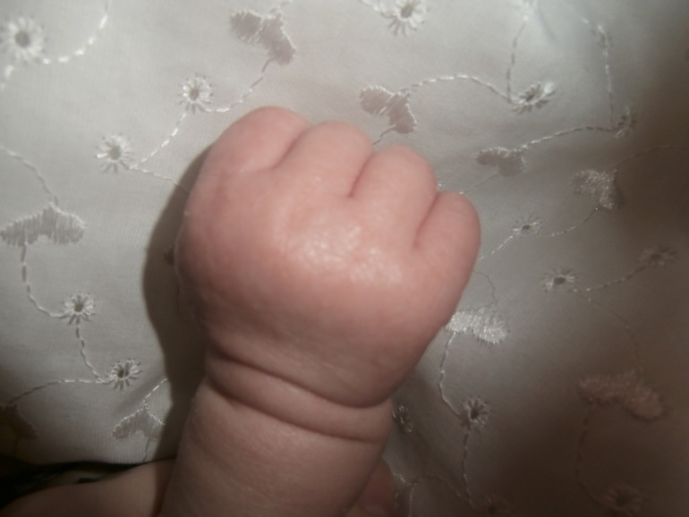 http://www.babyblog.ru/consultant/post/drmtlg/117389