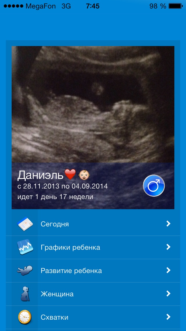 Да-да-да!!! НАМ СЕГОДНЯ 17 НЕДЕЛЕК!!
