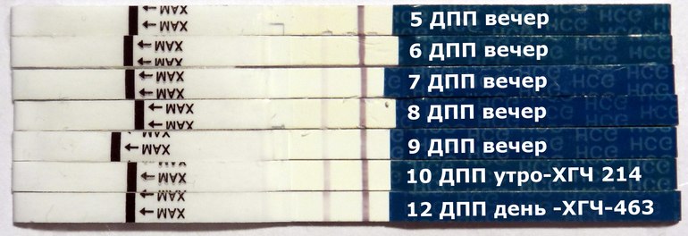 Наше первое УЗИ 20 ДПП