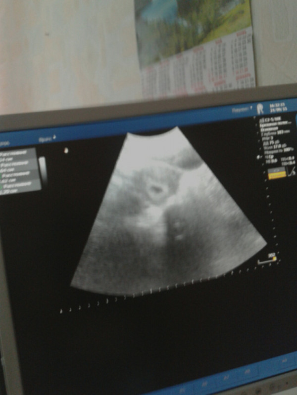 Узи 3 4 недели. Снимок УЗИ беременности 3-4 недели. Фотография УЗИ 4 недели беременности. УЗИ 4 недель беременности УЗИ. Снимок УЗИ на 4 неделе беременности.