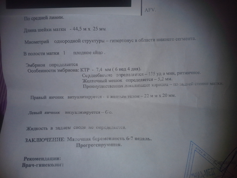 наше узи