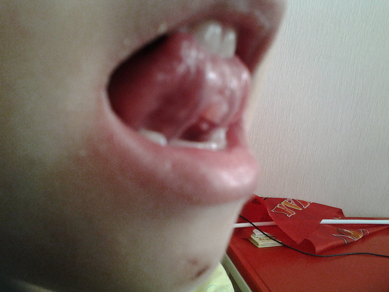 АТАС!!! Что это такое???