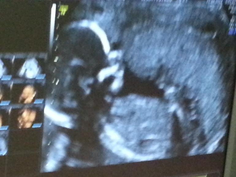 Даниелла 1 год:)))