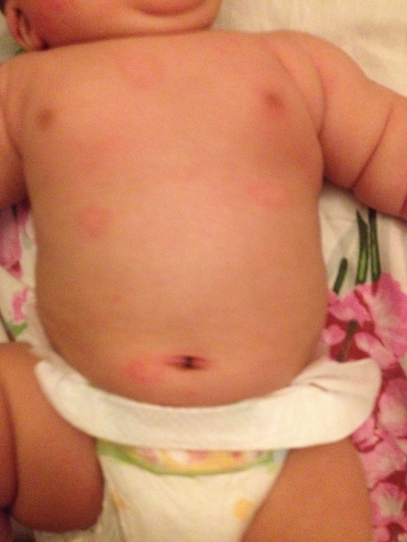 Что за пятна??