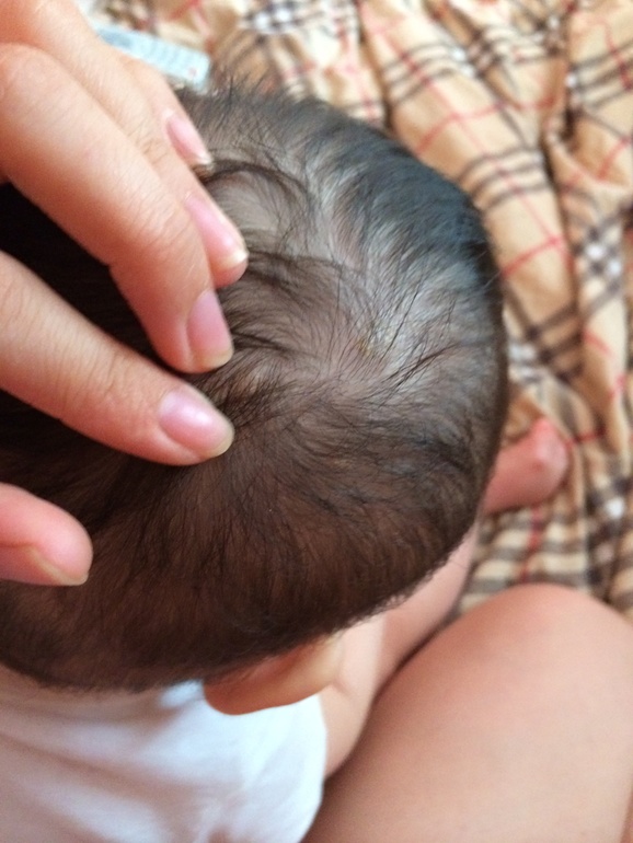 Сухие пятна на голове!