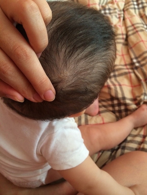 Сухие пятна на голове!