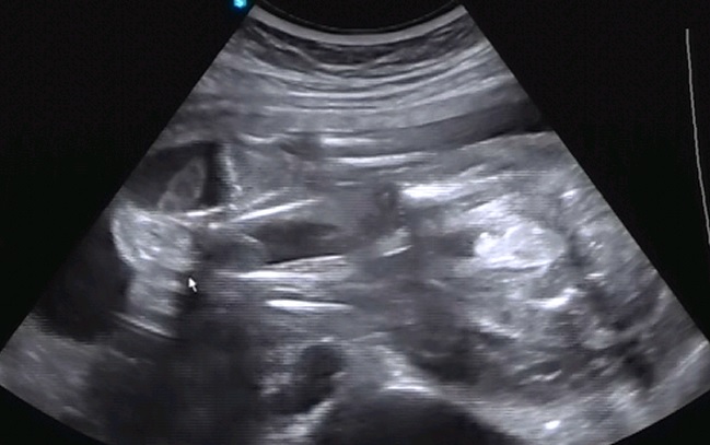 Мальчик или девочка?!