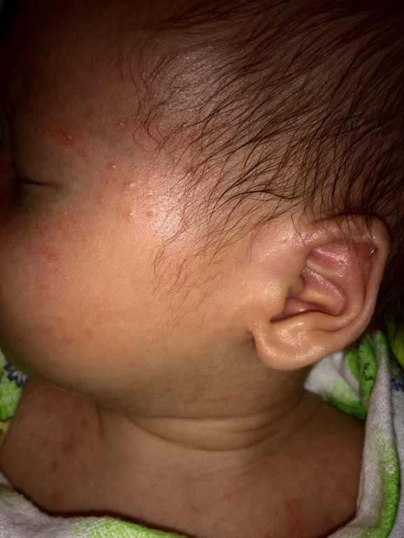 И высыпания, и запоры, и купаться боится(((((((((