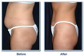 Простое решение больших проблем