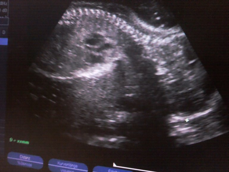 Наша 28 неделька