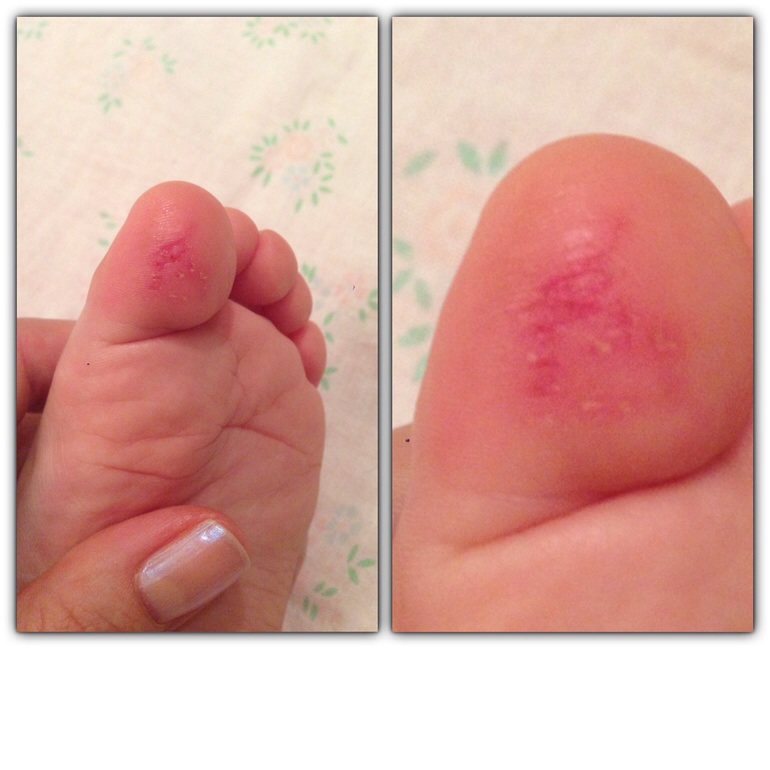 По-моему, нехватка витамина...