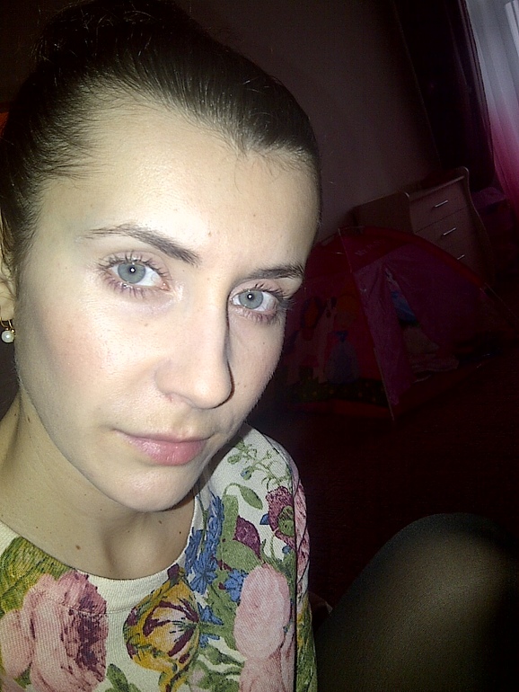 Ботокс под глаза и носогубки!!! Наконец-то!