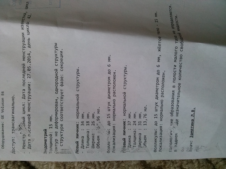 у меня была Овуляция!!!! даааааааа!!!