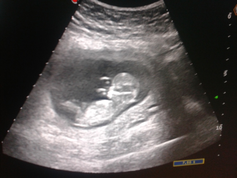 Видно кто или нет?