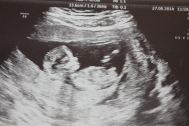 Наш первый скрининг