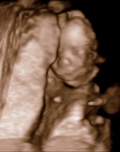 Наконец-то приветственный пост:)